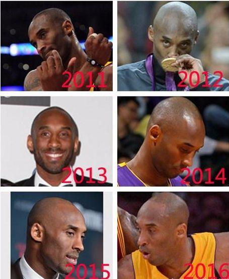 为什么nba球员容易掉头发（打球会脱发？NBA3大巨星的脱发之路：一图看詹姆斯发际线的变化 ）